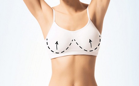 لیفت سینه (ماستوپکسی) در کلینیک زیبایی روژا